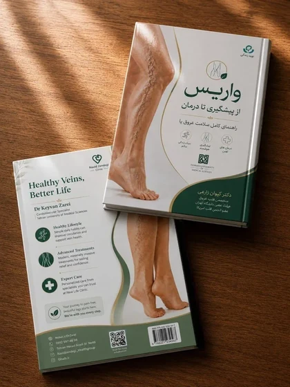 کتاب واریس از پیشگیری تا درمان